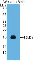 Monoclonal Antibody to Cytokeratin 19 (CK19)