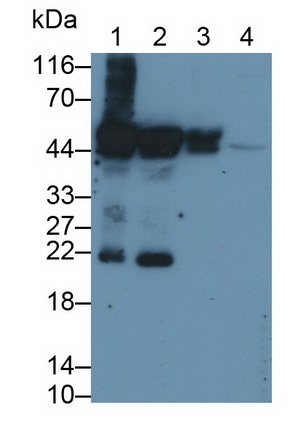 Monoclonal Antibody to Cytokeratin 20 (CK 20)