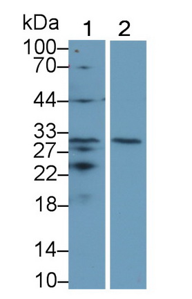 Monoclonal Antibody to Tumor Necrosis Factor Receptor Superfamily, Member 5 (CD40)