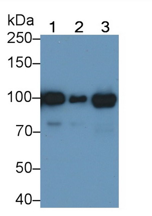 Monoclonal Antibody to Angiostatin (ANG)