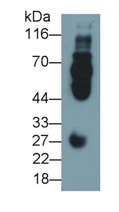 Monoclonal Antibody to Fc Fragment Of IgG Low Affinity IIIb Receptor (FcgR3B)