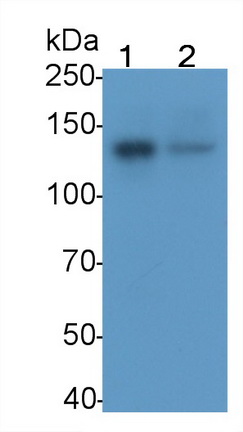 Monoclonal Antibody to Focal Adhesion Kinase (FAK)