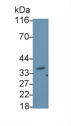 Monoclonal Antibody to Beta-1,3-Glucuronyltransferase 1 (b3GAT1)