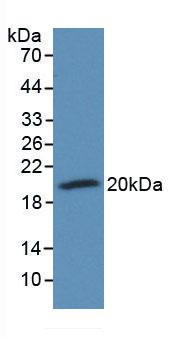 Monoclonal Antibody to Cluster of Differentiation 59 (CD59)