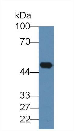 Monoclonal Antibody to Elastin (ELN)