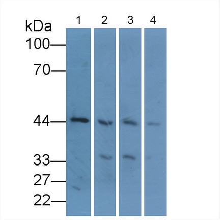 Monoclonal Antibody to Beta Actin (ACTB)