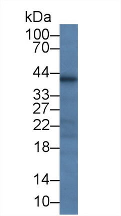 Monoclonal Antibody to Beta Actin (ACTB)