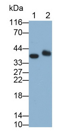 Monoclonal Antibody to Beta Actin (ACTB)