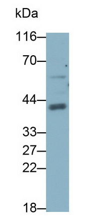 Monoclonal Antibody to Beta Actin (ACTB)