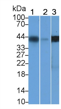 MAB341Hu25.jpg