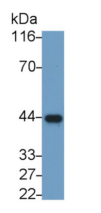 Monoclonal Antibody to Actin Alpha 2, Smooth Muscle (ACTa2)