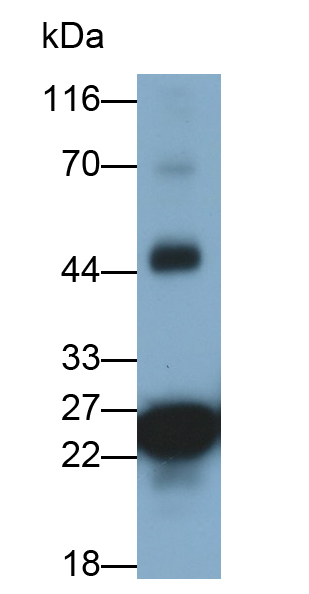 Monoclonal Antibody to Glucokinase Regulatory Protein (GKRP)