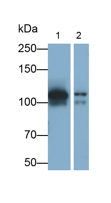 Monoclonal Antibody to Cadherin 5 (CDH5)