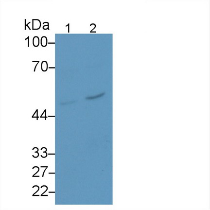 Monoclonal Antibody to Serpin B3 (SERPINB3)