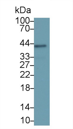 Monoclonal Antibody to Serpin B3 (SERPINB3)