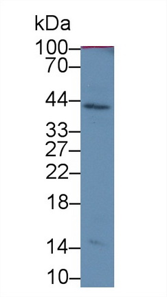 MAB372Hu24.jpg