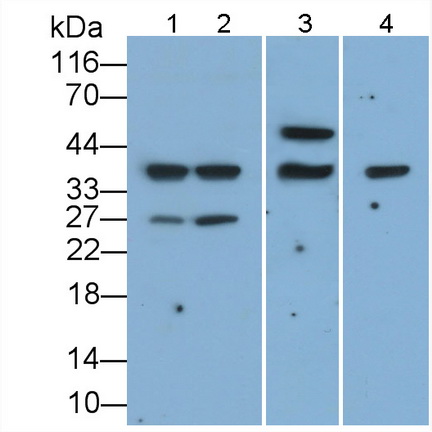 Monoclonal Antibody to Cluster of Differentiation 79B (CD79B)