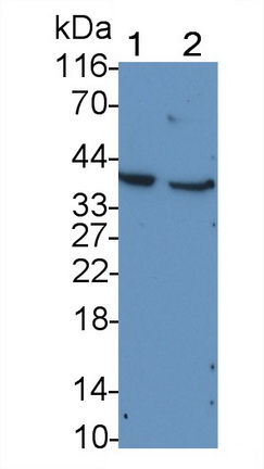 Monoclonal Antibody to Cluster of Differentiation 79B (CD79B)