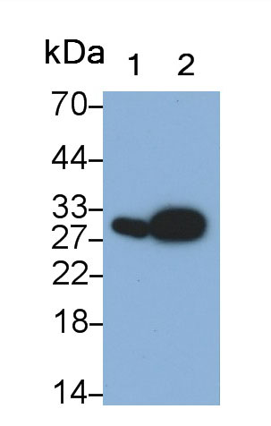 Monoclonal Antibody to Neutrophil gelatinase-associated lipocalin (NGAL)