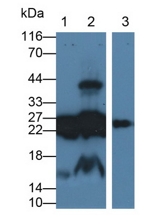 Monoclonal Antibody to Cluster of Differentiation 90 (CD90)