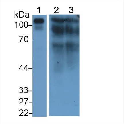 Monoclonal Antibody to Complement Component 1, Q Receptor (C1qR1)