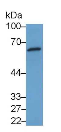 Monoclonal Antibody to Interferon Alpha/Beta Receptor 1 (IFNa/bR1)