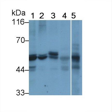 Monoclonal Antibody to Interferon Alpha/Beta Receptor 1 (IFNa/bR1)