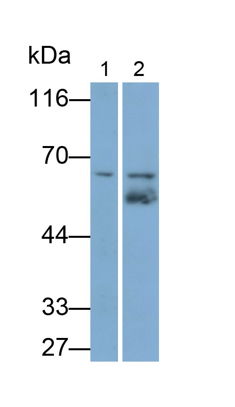 Monoclonal Antibody to Tyrosine Hydroxylase (TH)