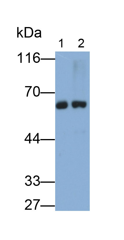 Monoclonal Antibody to Tyrosine Hydroxylase (TH)