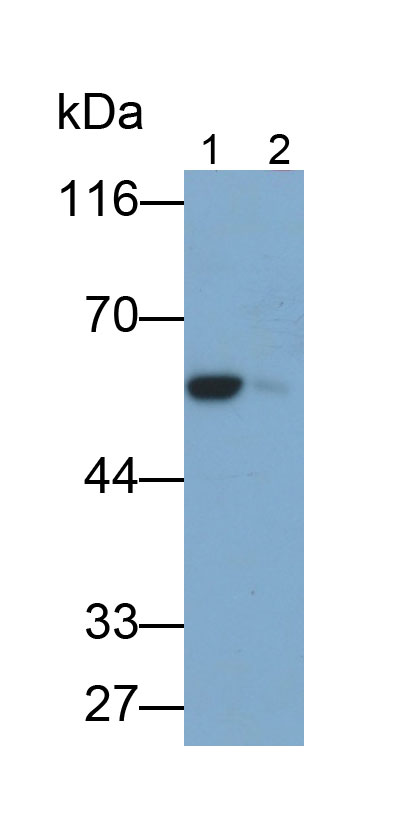 Monoclonal Antibody to Tyrosine Hydroxylase (TH)