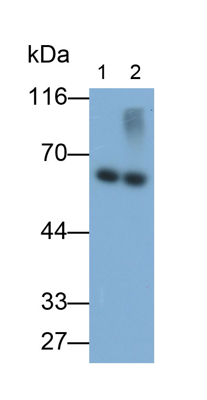 Monoclonal Antibody to Tyrosine Hydroxylase (TH)