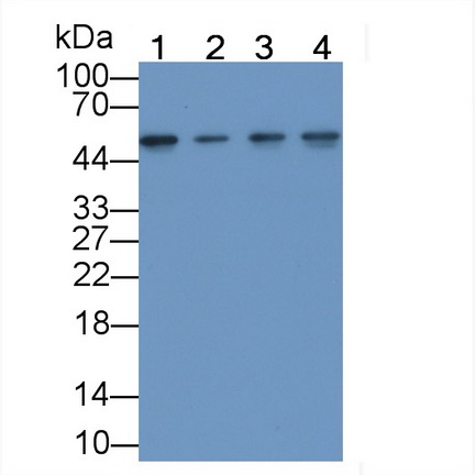 MAB449Hu22.jpg