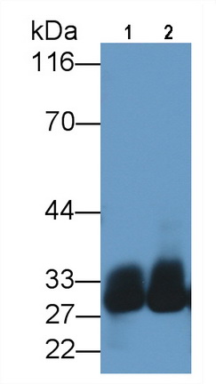 Monoclonal Antibody to Azurocidin (AZU)