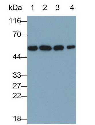 Monoclonal Antibody to Calreticulin (CALR)