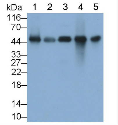 Monoclonal Antibody to Calreticulin (CALR)