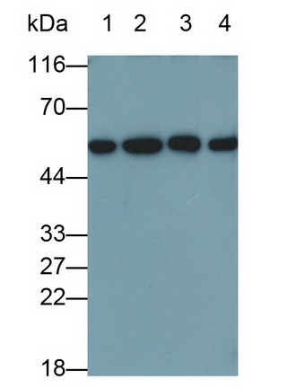 Monoclonal Antibody to Calreticulin (CALR)