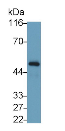 Monoclonal Antibody to Interferon Gamma Receptor 1 (IFNgR1)