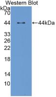 Monoclonal Antibody to Lumican (LUM)