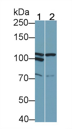 Monoclonal Antibody to Colony Stimulating Factor 2 Receptor Beta (CSF2Rb)