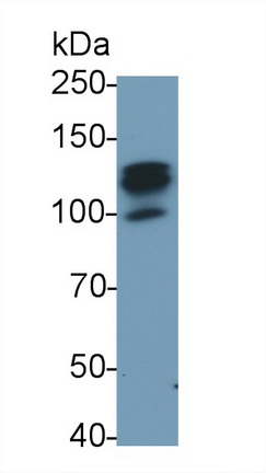 Monoclonal Antibody to Colony Stimulating Factor 2 Receptor Beta (CSF2Rb)