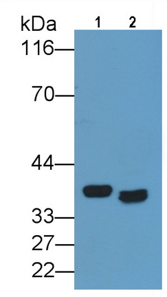 Monoclonal Antibody to Cluster Of Differentiation 147 (CD147)