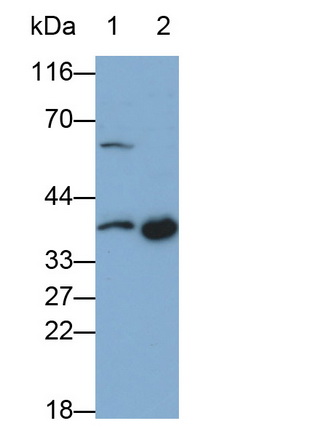 Monoclonal Antibody to Signaling Lymphocytic Activation Molecule Family, Member 1 (SLAMF1)