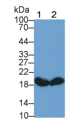 Monoclonal Antibody to Cofilin 1 (CFL1)