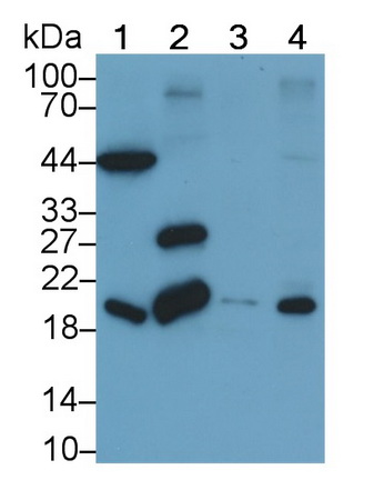 Monoclonal Antibody to Cofilin 1 (CFL1)