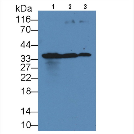 Monoclonal Antibody to Killer Cell Immunoglobulin Like Receptor 2DS4 (KIR2DS4)