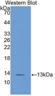 Monoclonal Antibody to Fatty Acid Binding Protein 1 (FABP1)