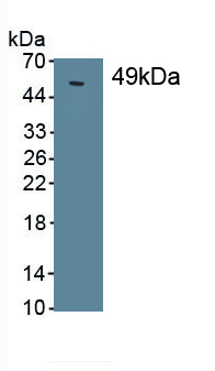 Monoclonal Antibody to Surfactant Protein C (SP-C)