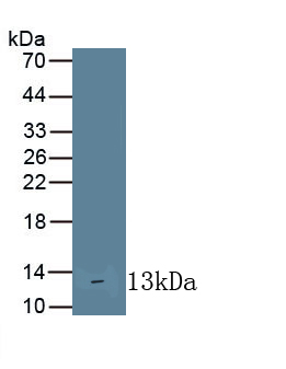 Monoclonal Antibody to Interleukin 10 Receptor Alpha (IL10Ra)