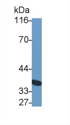 Monoclonal Antibody to Interleukin 10 Receptor Beta (IL10Rb)