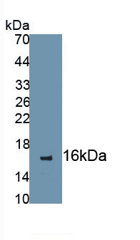 Monoclonal Antibody to Chemokine C-C-Motif Receptor 7 (CCR7)